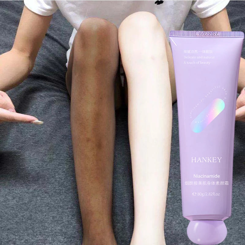 Remove Melanin Nicotinamide Brightening Cream For Dark Skin Effective Lighten Thigh Inner Bleach Private Parts Brighten Cream