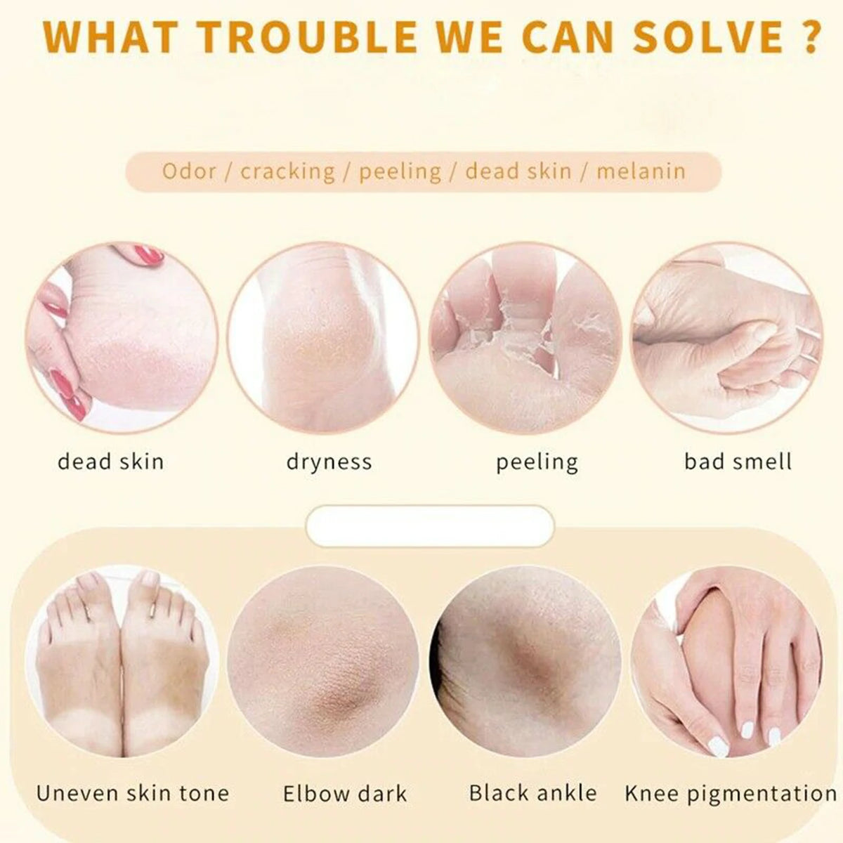 110ML Foot Peeling Spray  Improve Rough Skin Available For Whole Body