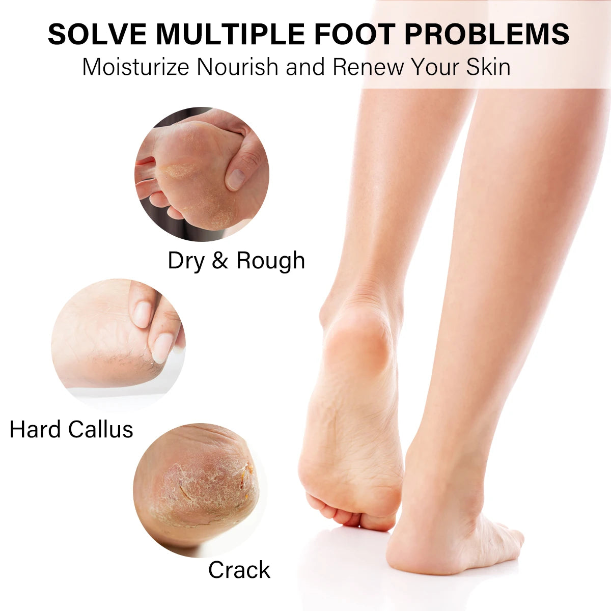 50Sets/Case FOOTNICE 4 Step Spa Pedicure Kit Foot Scrub Soak Herbal Spa Foot Peeling Skin Care 4 in 1 Deluxe Spa Pedicure Kit
