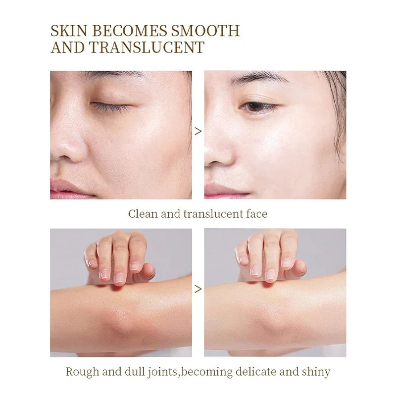 Orange Exfoliating Brightening Gel, Face Body Moisturizing Peeling Scrub, Deep Gentle Cleaning Pores, Remove Blackheads Exfoliat