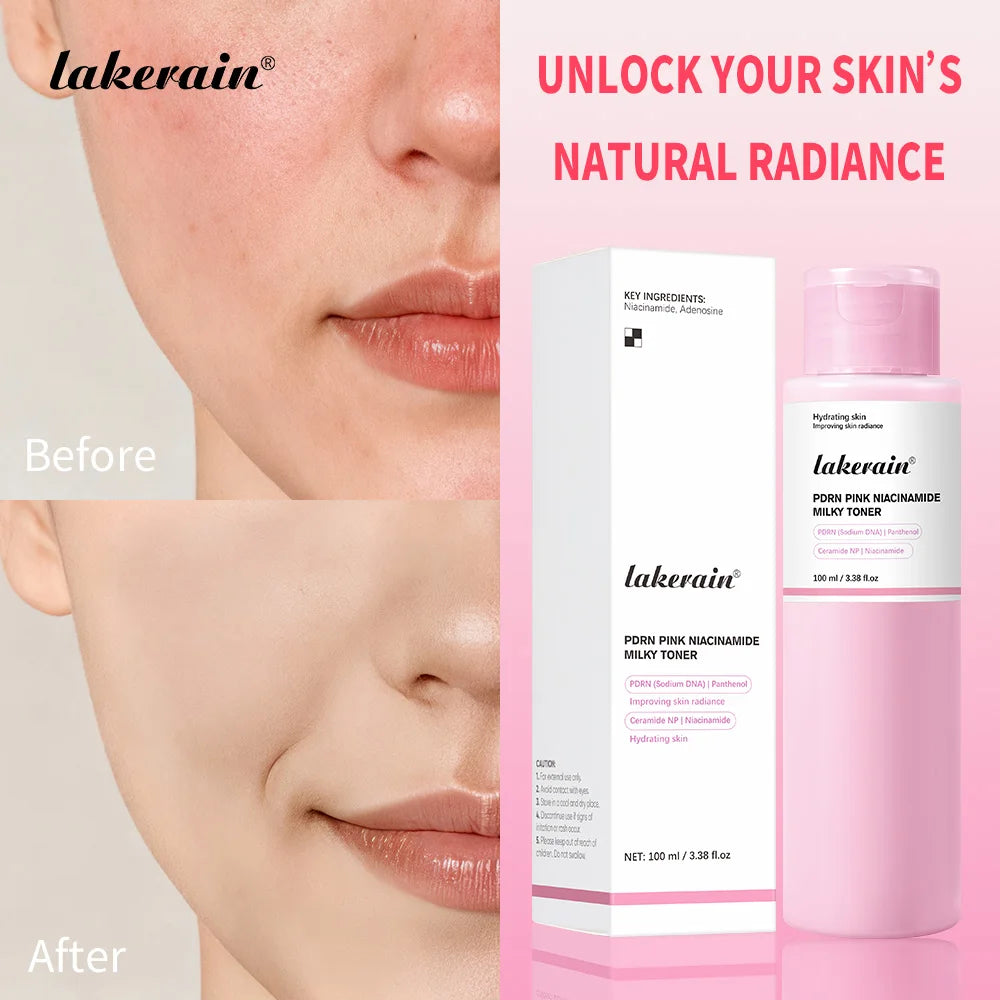 Pink Niacinamide Milky Toner Long-lasting Hydration Even Skin Tone Quickly Absorbed Achieve Dewy Glass Skin Daily Milky Toner