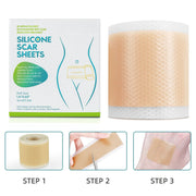 4cmx150cm Silicone Scar Sheets Removal Strips Silicone Gel Scar Strip For Acne Keloid Surgery Burn Treatment Scar Patch Hot Sale