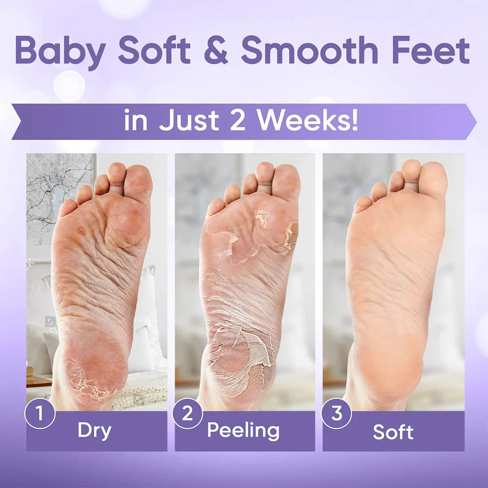 1-20Pair Exfoliating Feet Mask Exfoliating Foot Peel Mask Socks Pedicure Peeling Dead Skin Remover Feet Mask Peel Moisturizing