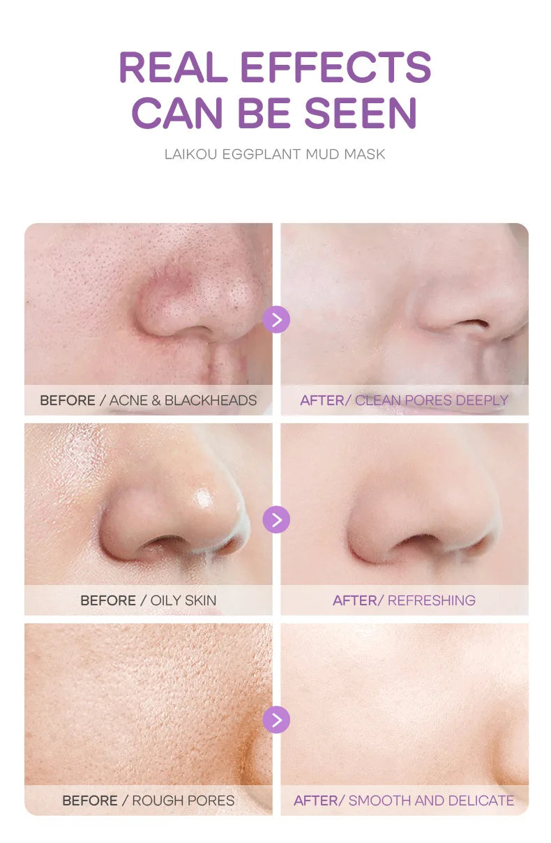 5pcs LAIKOU Eggplant Mud Mask Oil Control Moisturizing Anti-Acne  Anti Wrinkle Whitening Cleansing Clay Mask Skin Care Face Mask