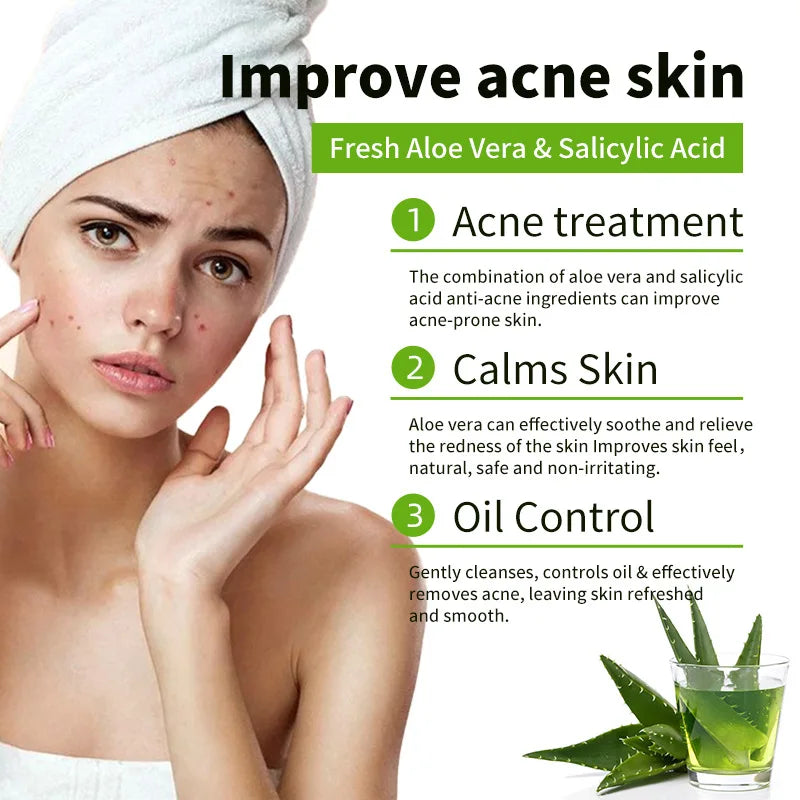 1/2/4/6Pcs Aloe Vera Whitening Soap, Remove Acne, Pimples, Skin Radiant, Improve Skin Luster, Vegan Bath Wash for All Skin Types