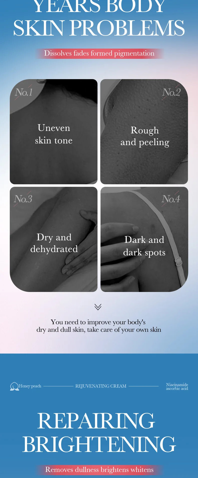 Remove Melanin Nicotinamide Brightening Cream For Dark Skin Effective Lighten Thigh Inner Bleach Private Parts Brighten Cream