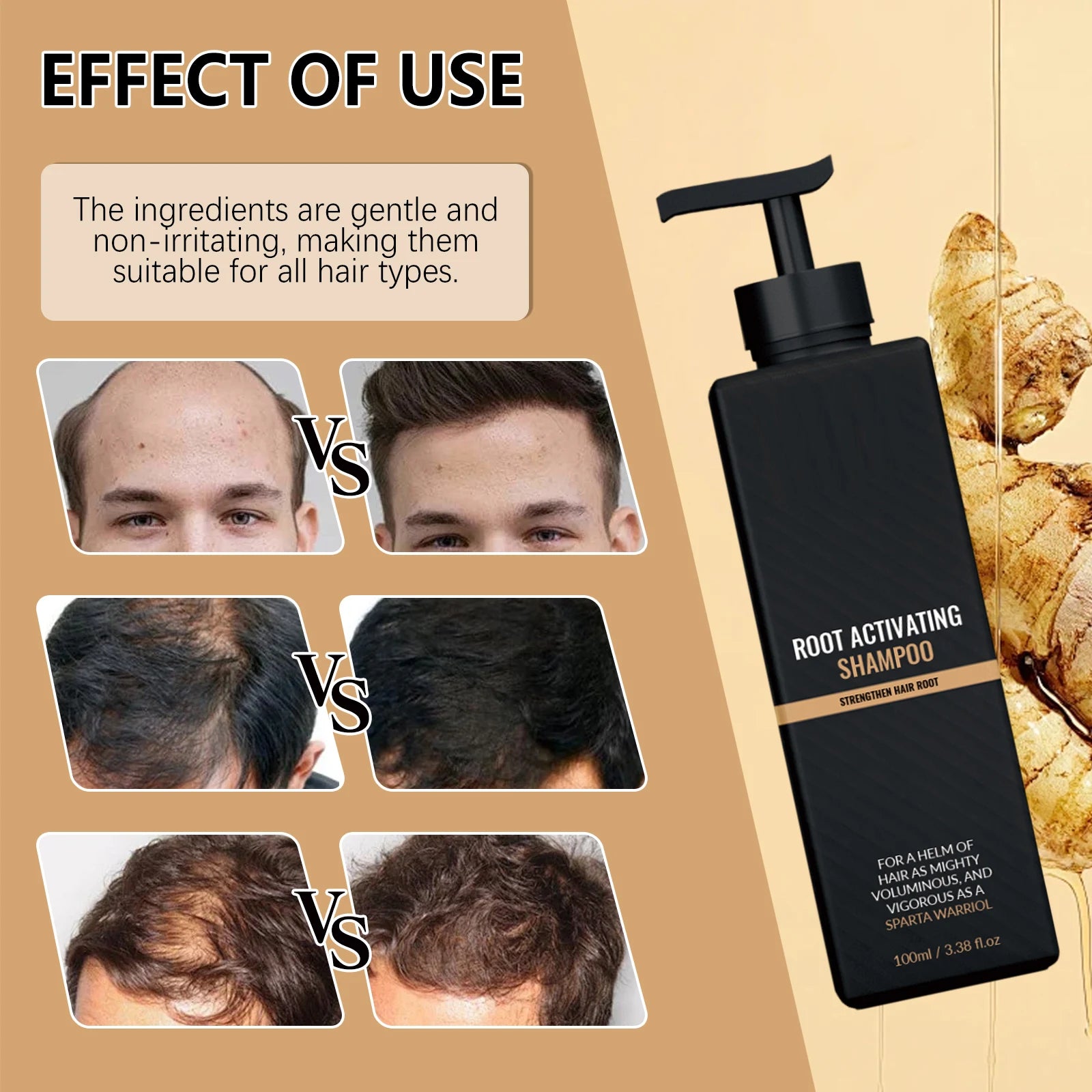 Volumizing Scalp Care Shampoo Deep Cleansing Ginger Extract Natural Formula Hair Strengthening Nourishing For Oily Hair All Type