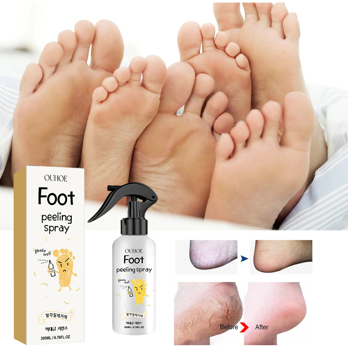 Foot Exfoliating Spray Repairing and Brightening, Removes Dead Skin and Calluses, Foot Whitening Care Spray Foot Care Liquid
