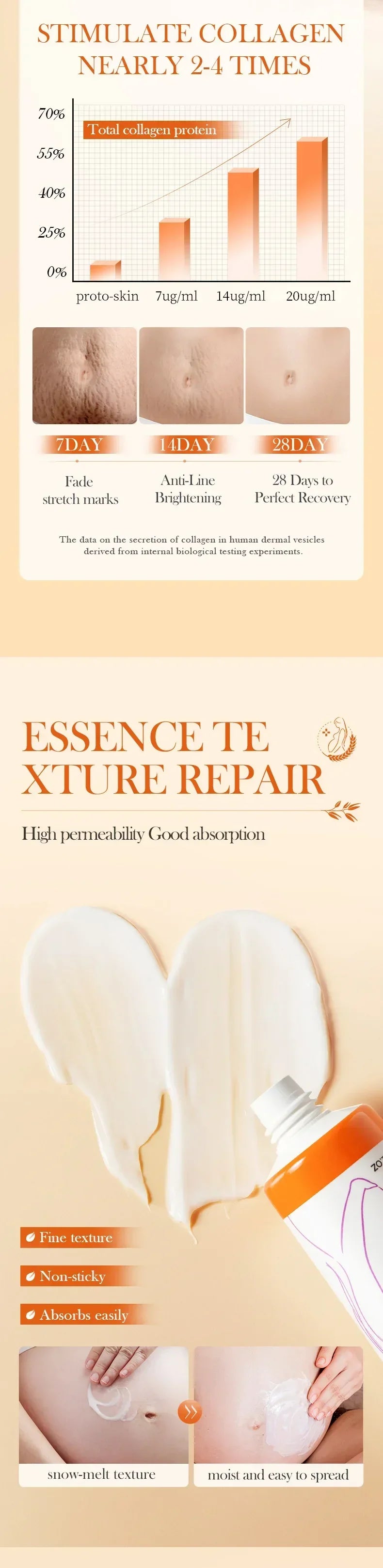 Stretch Marks Removal Cream Light Lines Postpartum Obesity Pregnancy Powerful Fast Absorption