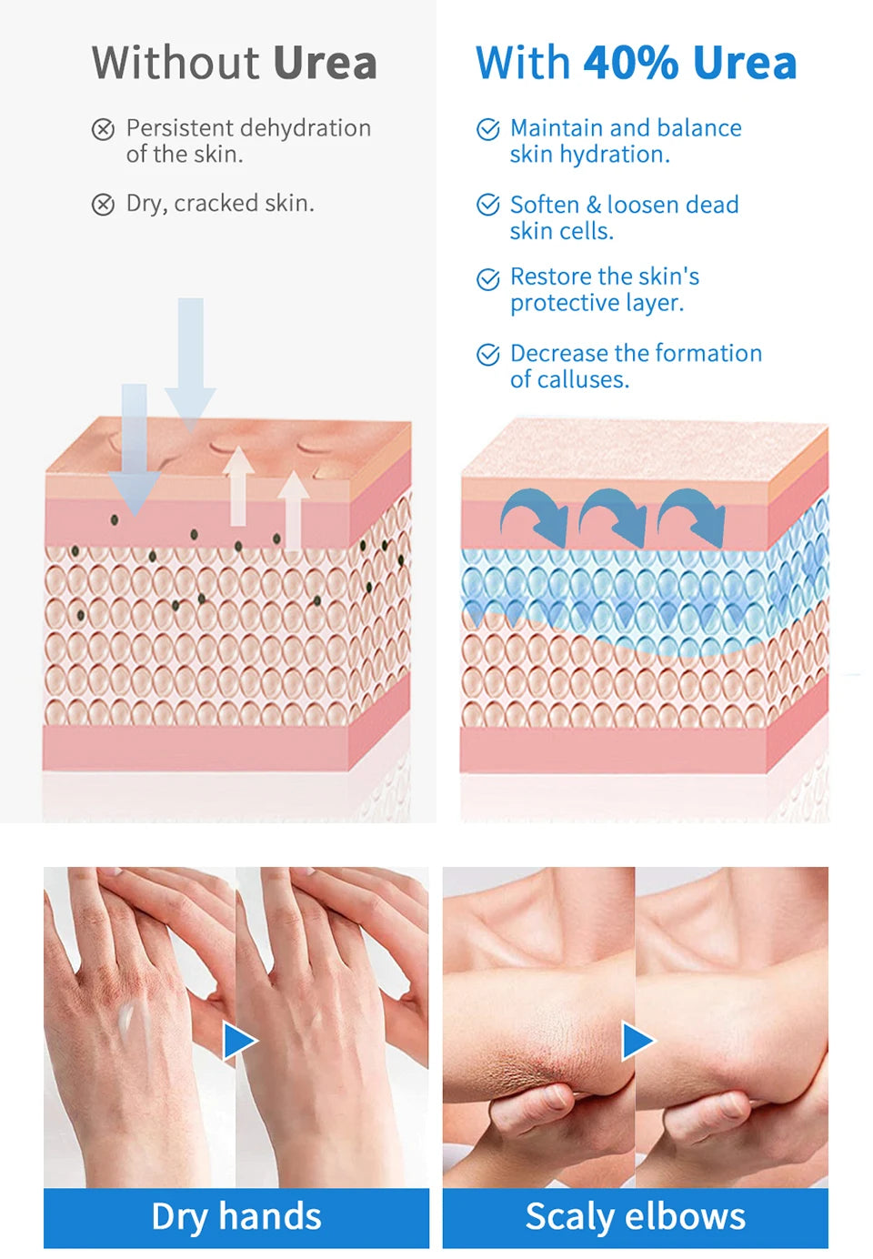 New 42% Urea Cream + 2% Salicylic acid Foot and hand Moisturizer, deep moisturizer and Nourishing moisturizer