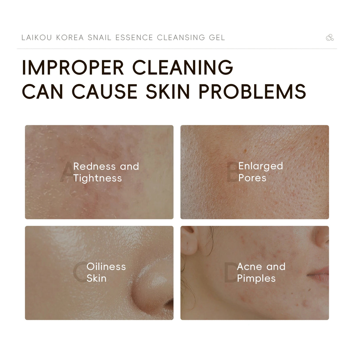 LAIKOU Korea Snail Essence Cleansing Gel 50g Low PH Gentle Cleansing Moisturizing Clear Tender Skin Daily Face Wash