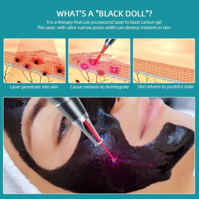 Carbon Gel Black Face Cream Mask Facial Deep Cleaning Support Laser Active Nano Toner Skin Rejuvenation Whitening Care Tools
