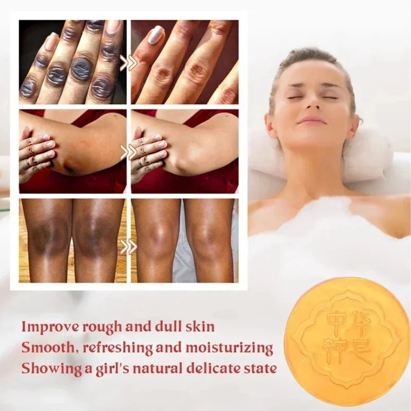 Body Natural Herb Soap For Deep Skin Exfoliation Brightening Body Soap Knees Intimate Parts Armpits Light Nourishing Care Soap