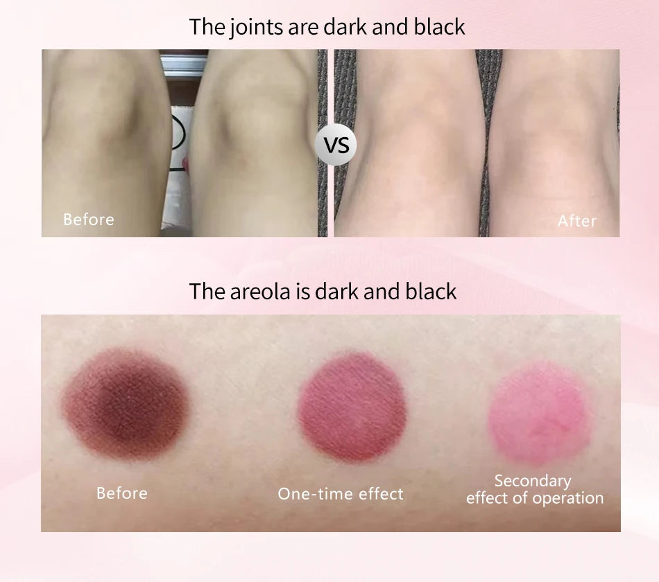 SOBER SKIN Natural Rose Lip Care Rose Scrub Lip Balm Lighten Dark Lip Color Brighten Roma Pink Lip