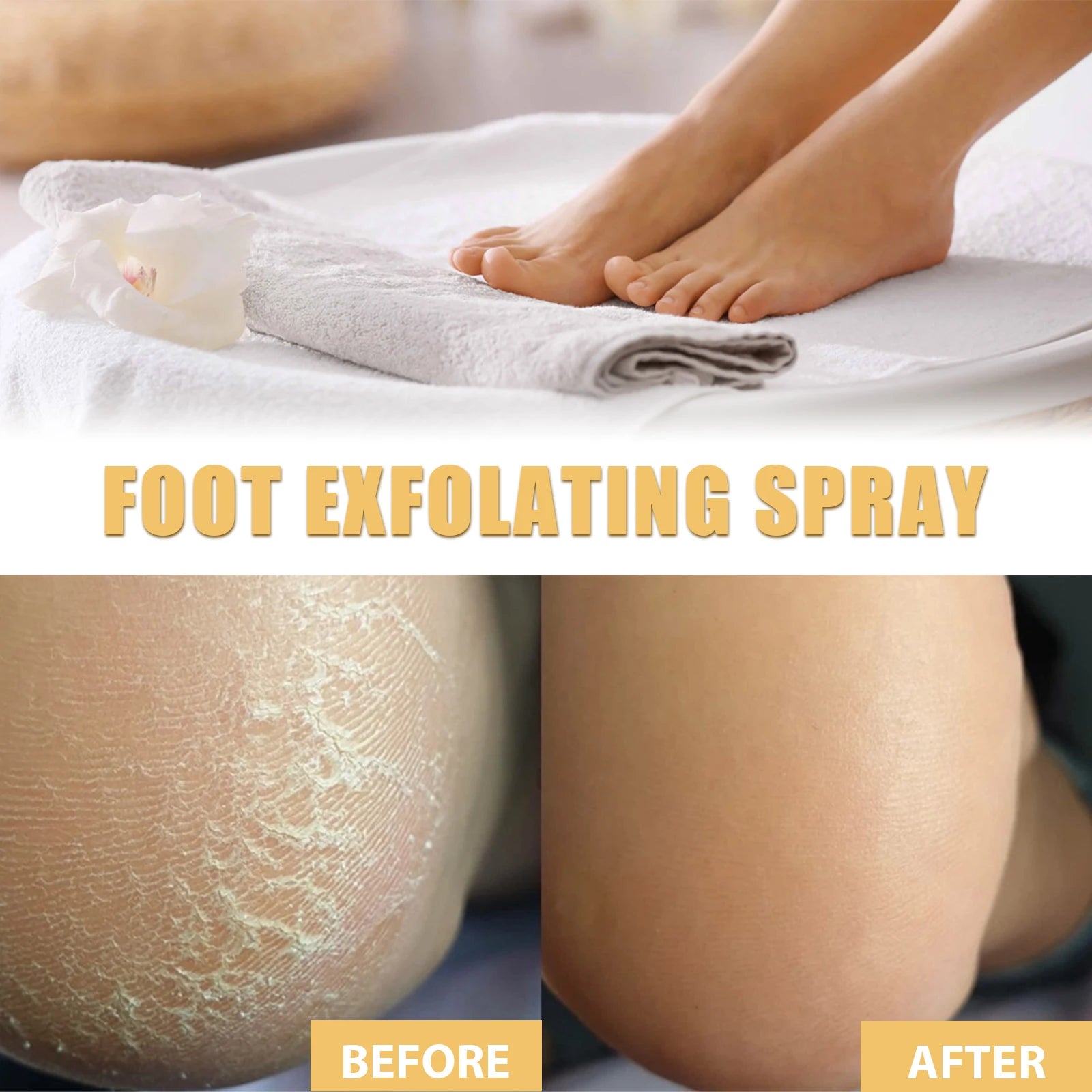 Foot Exfoliating Spray Repairing and Brightening, Removes Dead Skin and Calluses, Foot Whitening Care Spray Foot Care Liquid