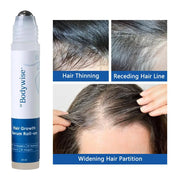 25ml 3% Rosemary Hair Growth Serum - Deep Scalp Nourishment Frizz Control Strengthen Hair Roots Hair Care Essence Oil