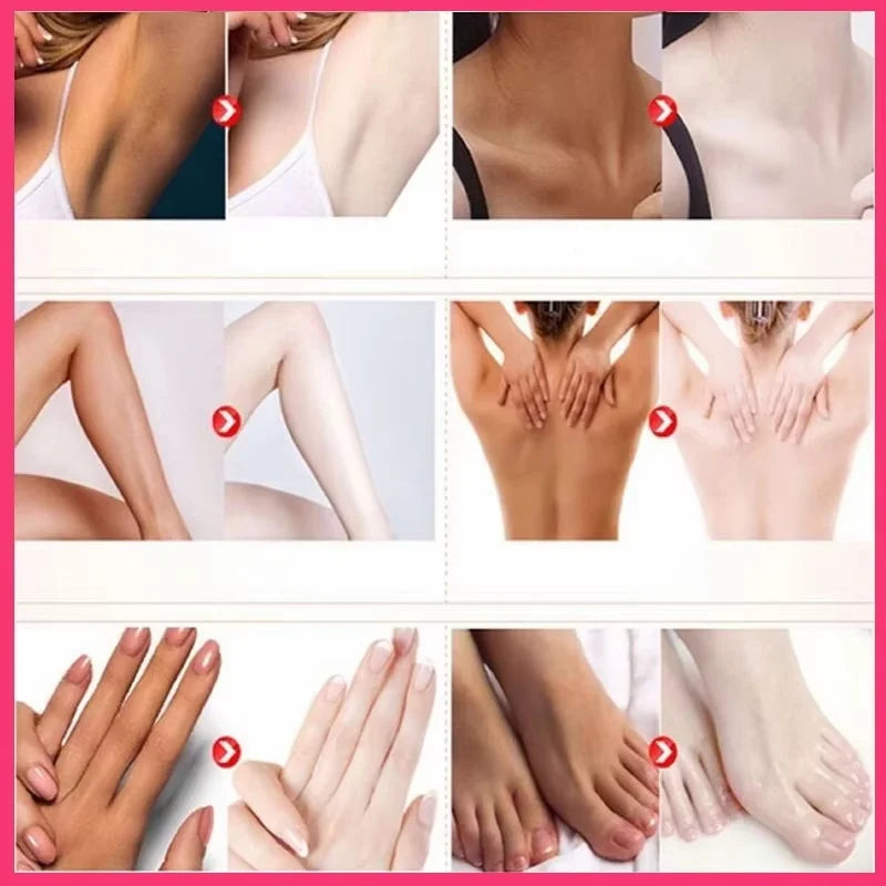 Niacinamide Body Whitening Cream For Underarm Bleaching Armpit Lightening Intimate Area  Moisturizer Korean Skin Care Product
