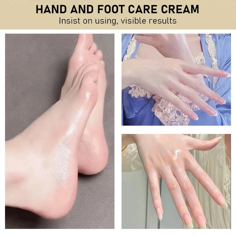 Cracked Hands and Feet Ointment Is Rich in Honey and Hyaluronic Acid, Deeply Moisturizes, Say Goodbye to Dry Hands and Feet, Allow Soft and Smooth Skin on Hands and Feet