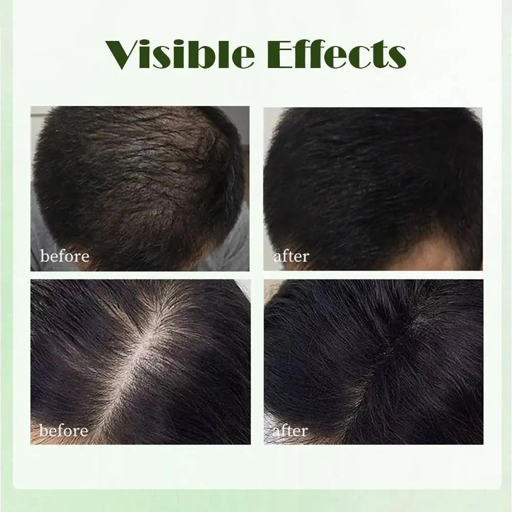 Original Platycladi Usman grass handmade shampoo soap Polygonum multiflorum anti-removal solid hair nourishing hair control oil