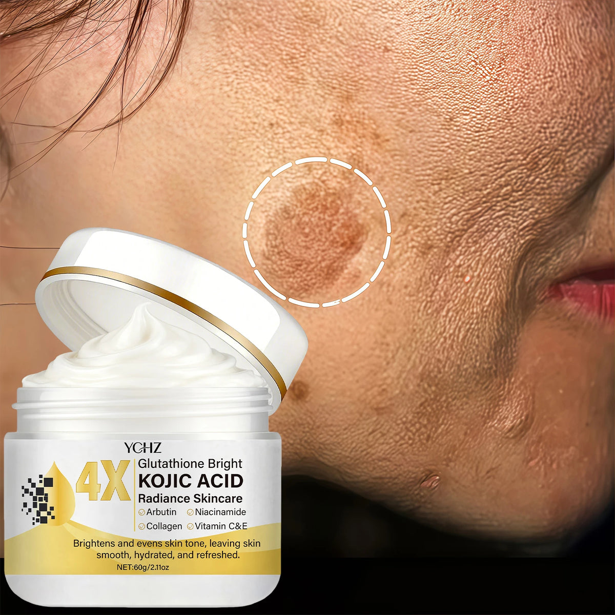 Kojic Acid Face Cream, Evens Out Skin Tone, Eliminates Dark Spots and Dullness - Non-Greasy, Suitable for Both Men and Women - Whitening and Moisturizing Cream, for Day and Night Use - 60g