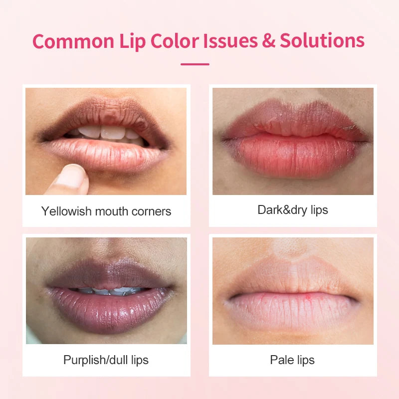 SOBER SKIN Natural Rose Lip Care Rose Scrub Lip Balm Lighten Dark Lip Color Brighten Roma Pink Lip