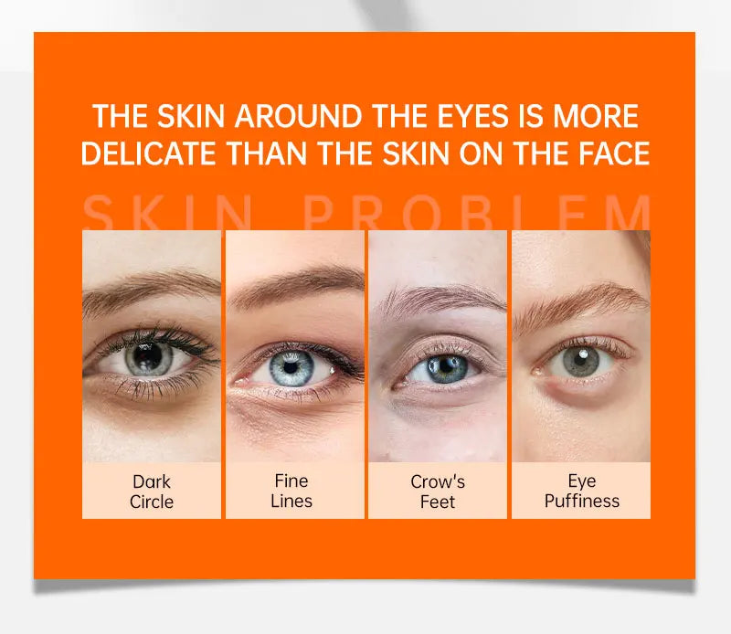 JoyPretty Anti Dark Circle Eye Cream Eye Bags Removal Vitamin C Whitening Cream Wrinkle Removal Serum Eyes Firming Skin Care