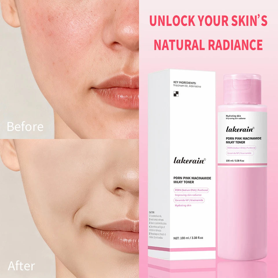 Pink Niacinamide Milky Toner Long-lasting Hydration Even Skin Tone Quickly Absorbed Achieve Dewy Glass Skin Daily Milky Toner
